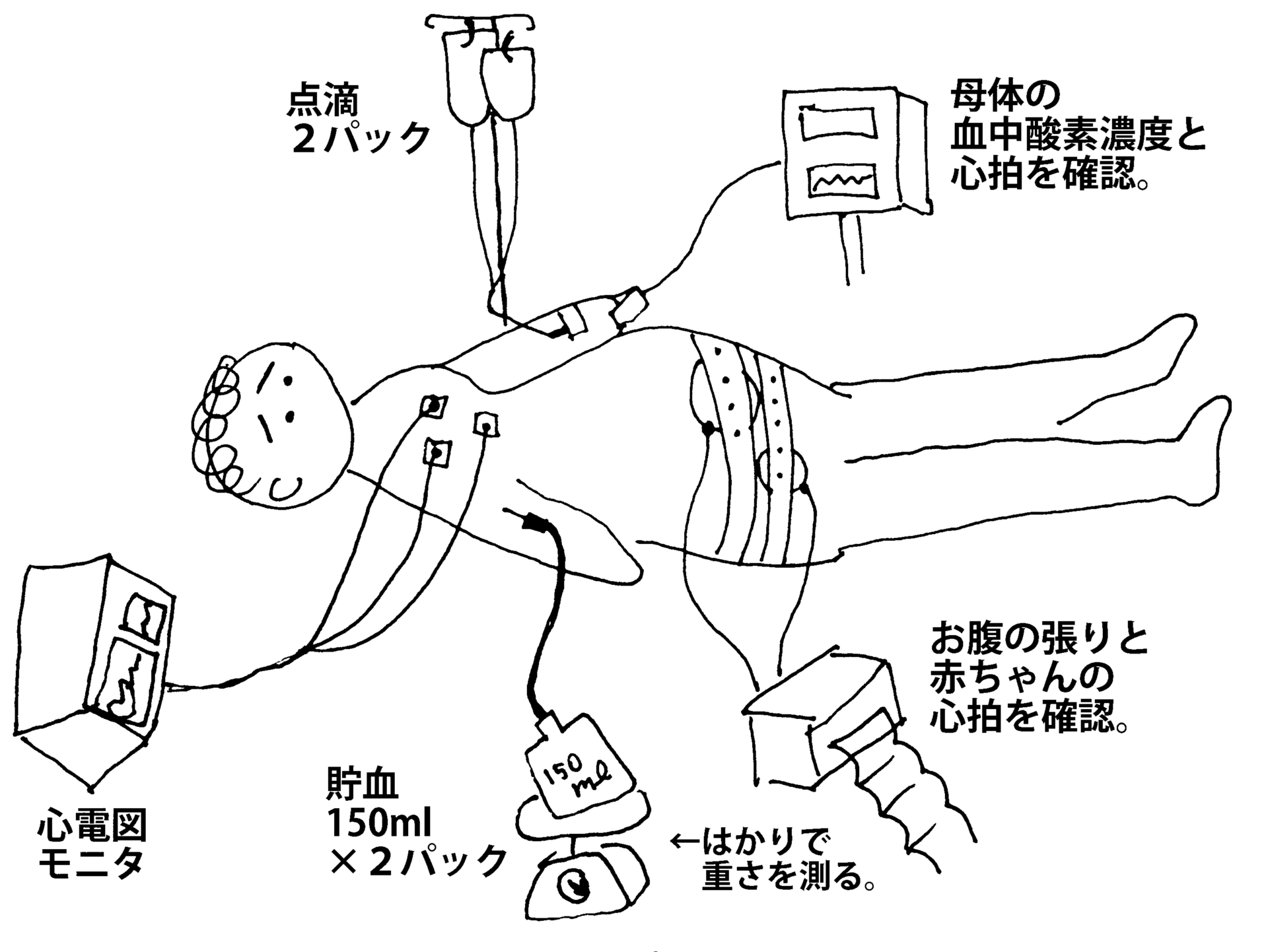 離島で妊婦